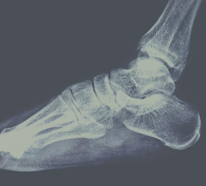 Echografisch onderzoek