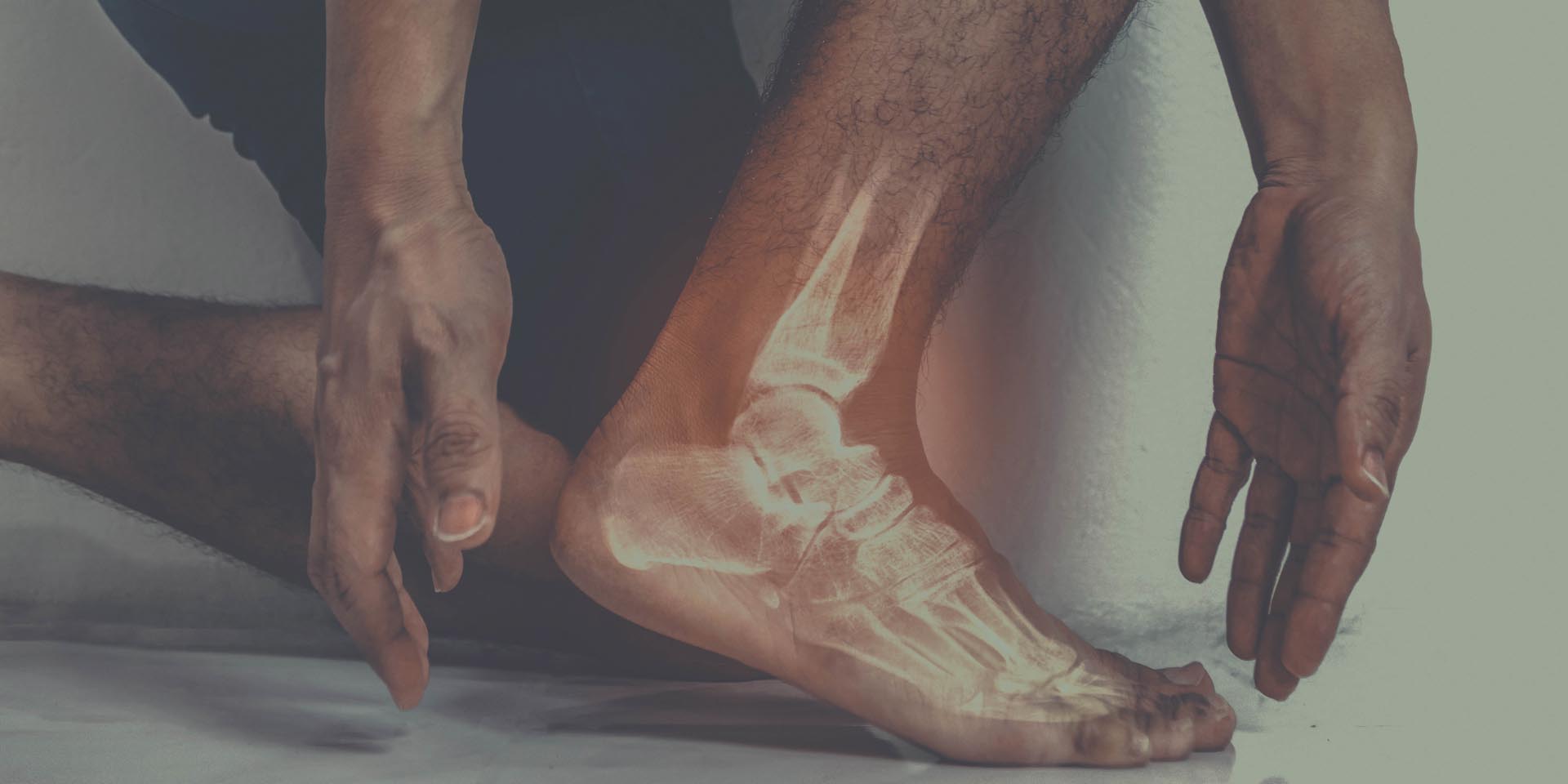 TTS tarsaal tunnel syndroom