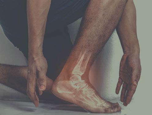 TTS Tarsaal Tunnel Syndroom