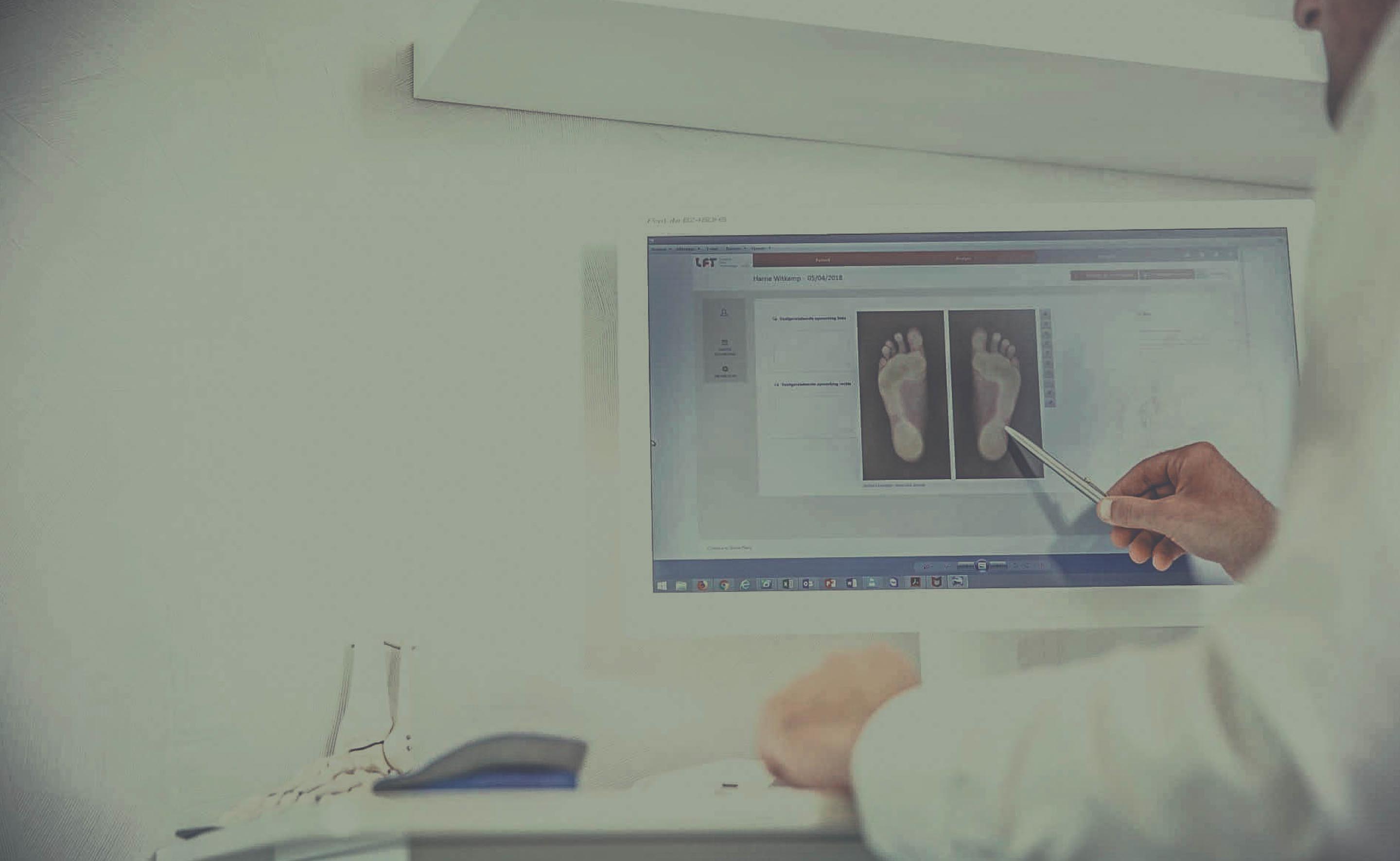Statische afdruk van de voet middels een voetscan of blauwdrukraam